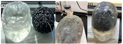 <mark class="highlighted">Safety Study</mark> of Combination Treatment: Deep Brain Stimulation and Transcranial Magnetic Stimulation